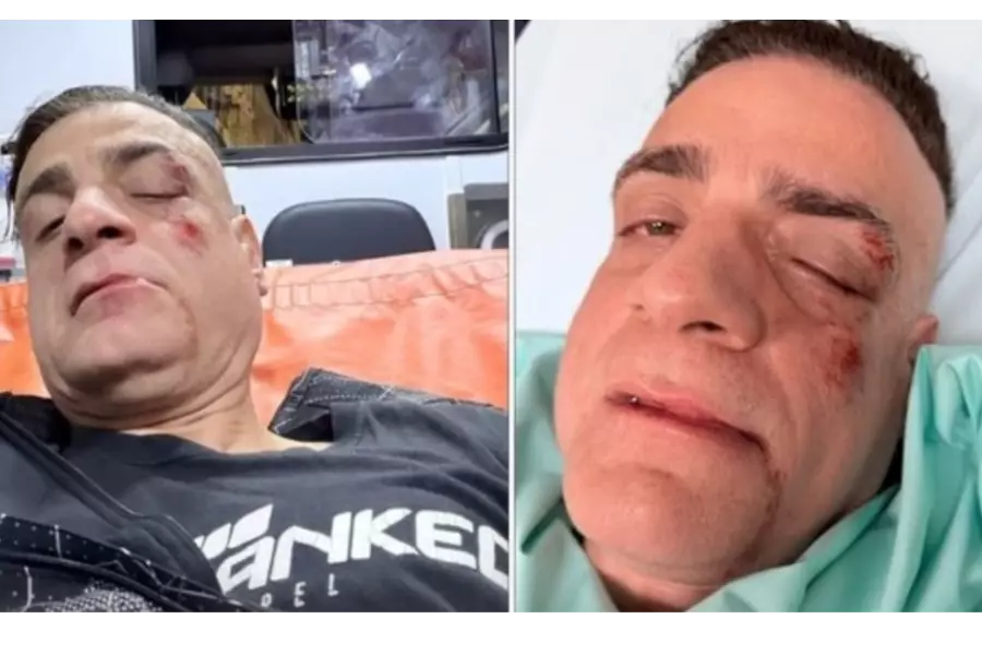 В Риме атаковали блогера-борца с карманниками, полиция начала расследование