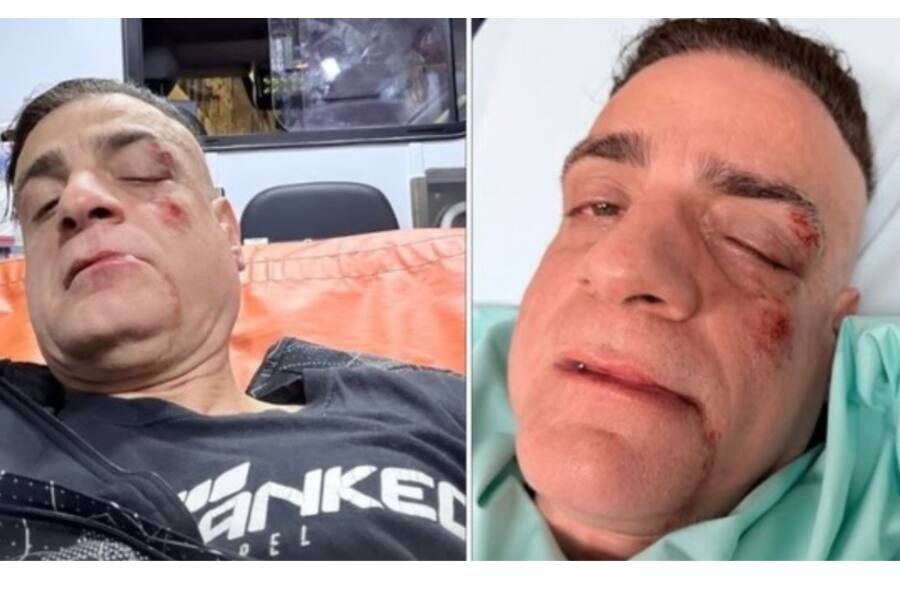 В Риме атаковали блогера-борца с карманниками, полиция начала расследование